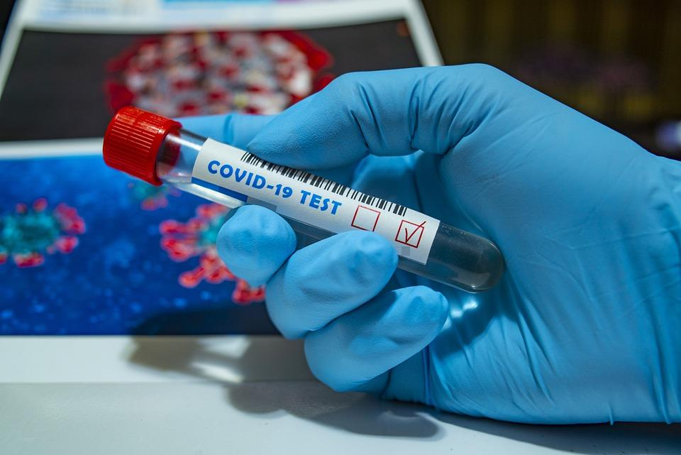 Более 16 тысяч исследований на коронавирус проведено в Мордовии