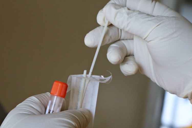 Еще 89 новых случаев коронавируса зарегистрировано в Мордовии