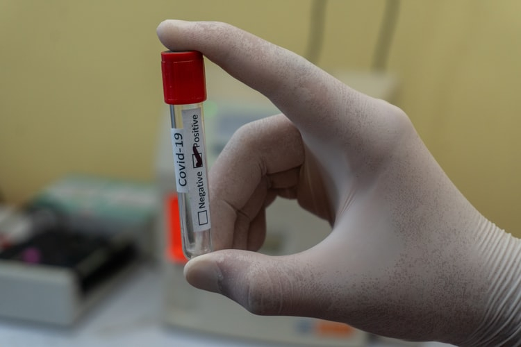 Минздрав озвучил предполагаемые сроки окончания пандемии коронавируса