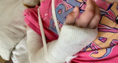 Жительница Саранска пожаловалась на халатность в детсаде из-за перелома руки